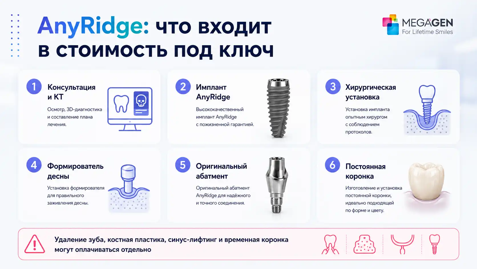 Что входит в стоимость имплантации AnyRidge под ключ