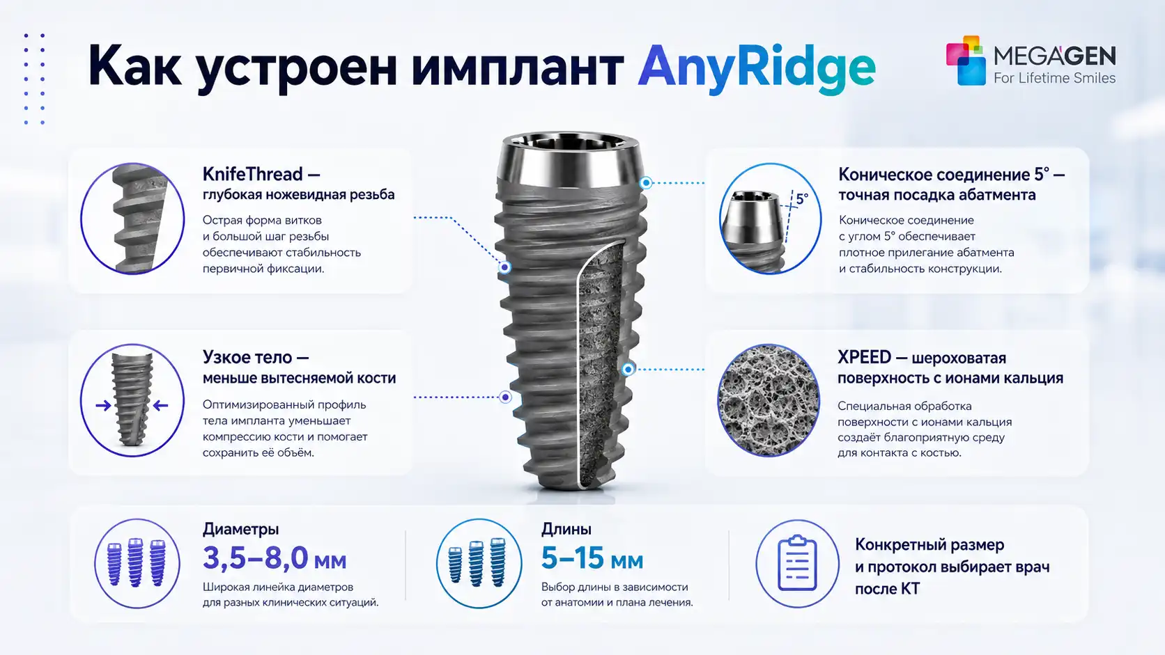 Технологии имплантов AnyRidge: KnifeThread, XPEED и коническое соединение