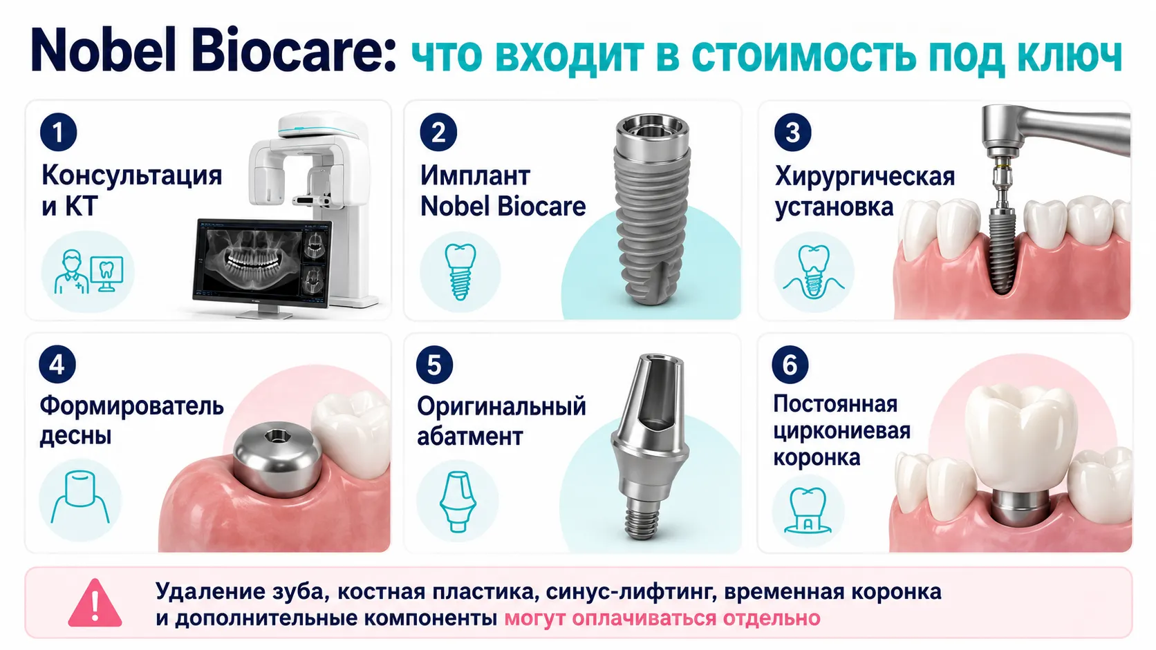 Что входит в стоимость имплантации Nobel Biocare под ключ