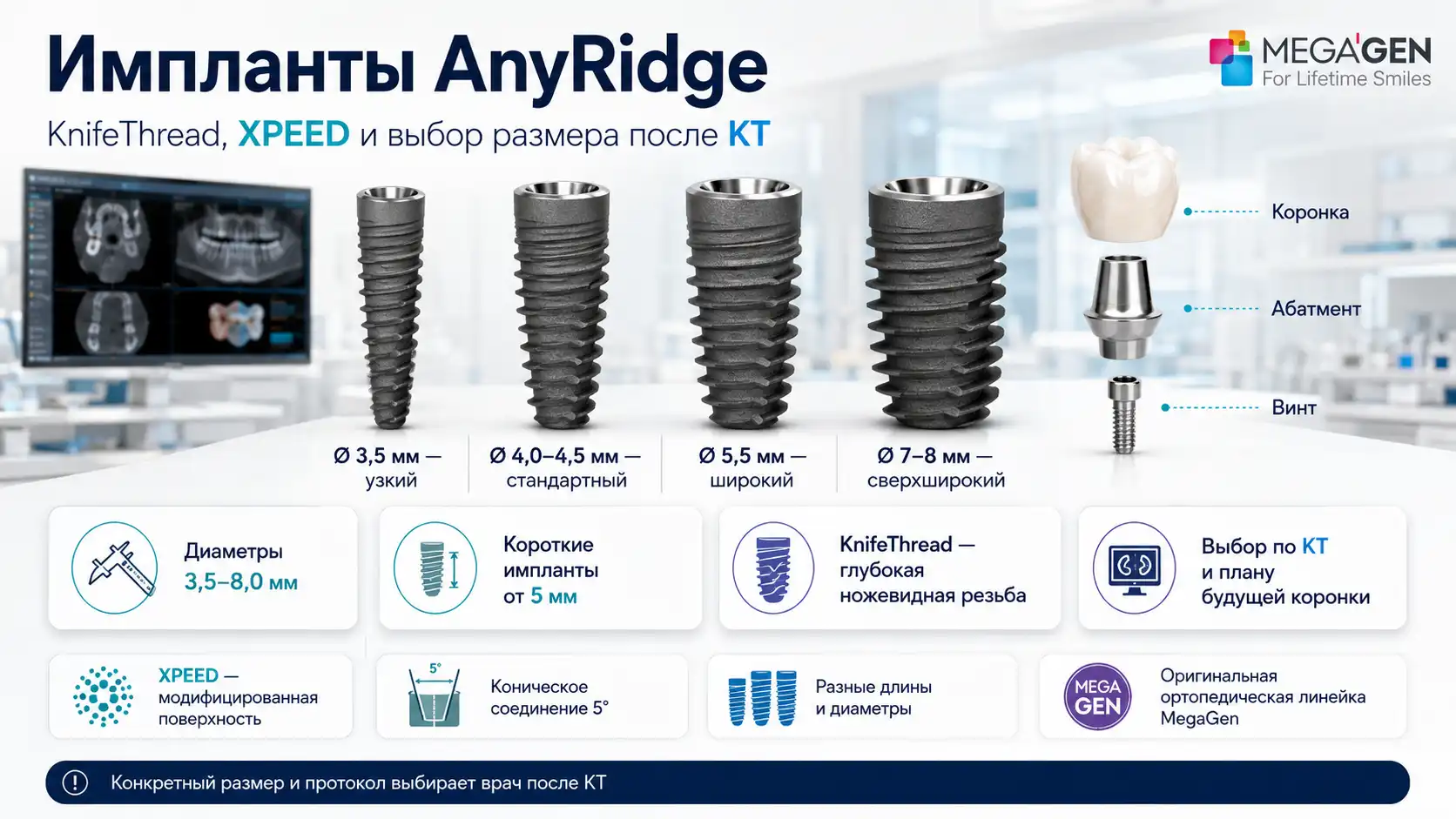 Импланты AnyRidge разных диаметров